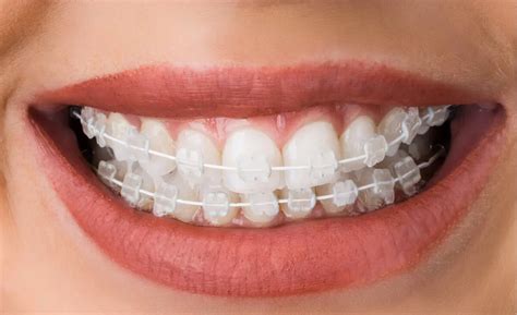 gentle dental and orthodontics.